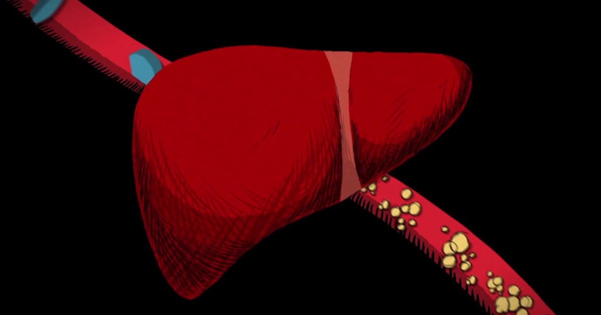 The Cholesterol Question