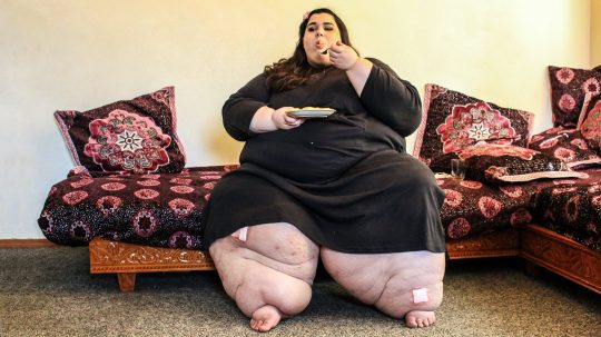 My 600-lb Life - 1. epizoda