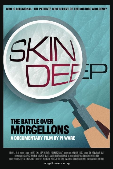 Plakát Skin Deep: The Battle Over Morgellons